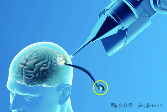 暗区突围自瞄_暗区突围操作_暗区突围辅助使用
